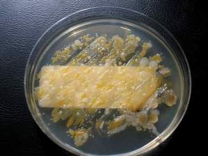One student's fast-growing bacteria culture