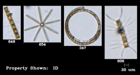 A sampling of phytoplankton   imaged by the LIME's FlowCam. 